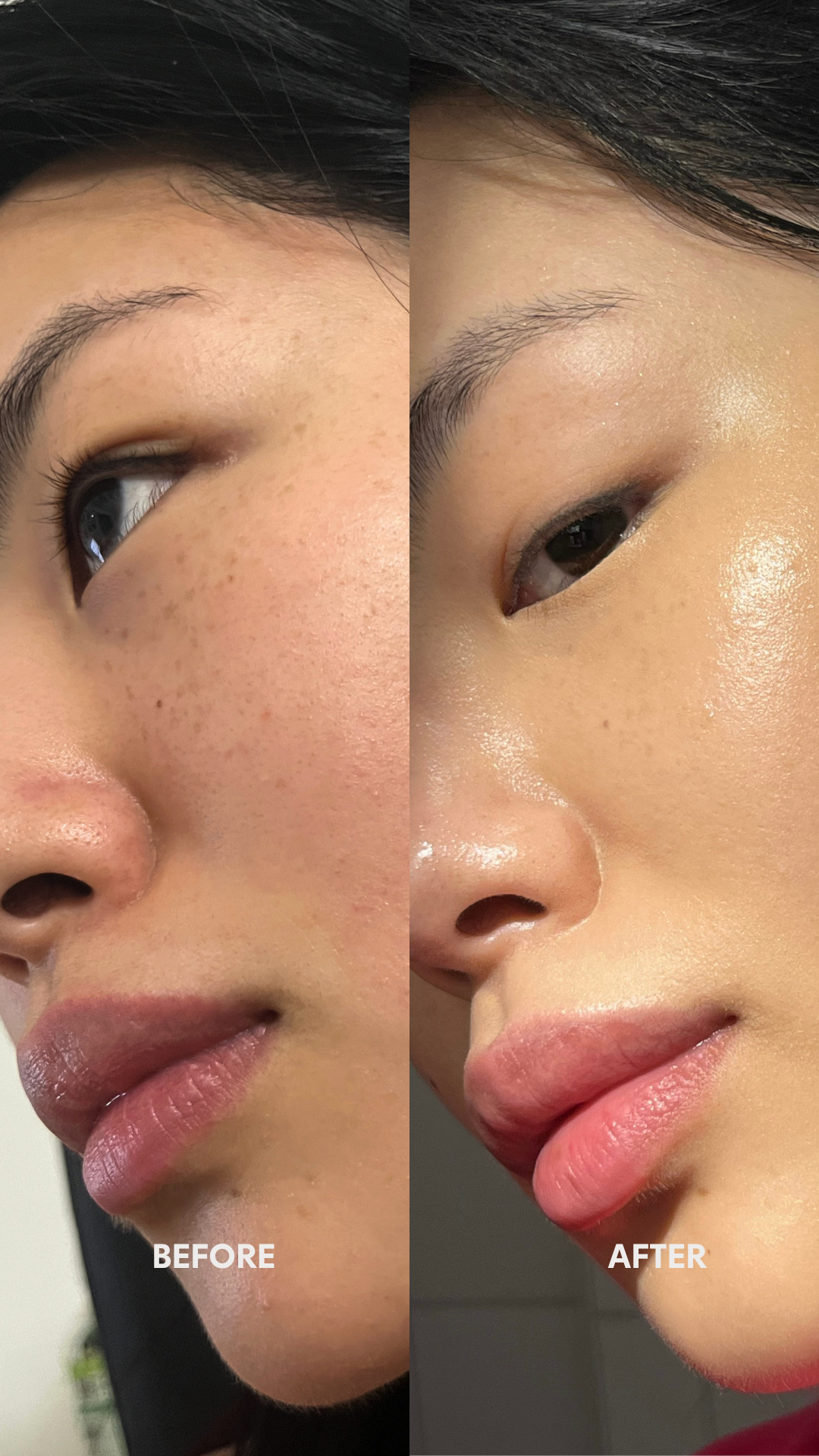 before and after face showing clearer smoother skin after using Irritated serum for sensitive skin
